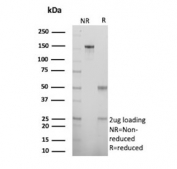 SDS-PAGE analysis of purified, BSA-free S100 Calcium Binding Protein A2 antibody (clone rS100A2/6482) as confirmation of integrity and purity.