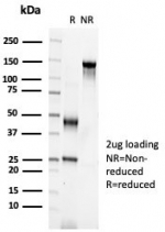 SDS-PAGE analysis of purified, BSA-free S100A2 antibody (clone S100A2/6925) as confirmation of integrity and purity.