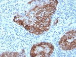 IHC staining of FFPE human cervix tissue with S100A2 antibody (clone S100A2/6925). HIER: boil tissue sections in pH 9 10mM Tris with 1mM EDTA for 20 min and allow to cool before testing.