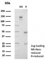 SDS-PAGE analysis of purified, BSA-free S100A5 antibody (clone S100A5/7472) as confirmation of integrity and purity.