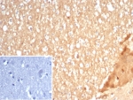IHC staining of FFPE human brain tissue with S100A5 antibody (clone S100A5/7472). Inset: PBS used in place of primary Ab (secondary Ab negative control). HIER: boil tissue sections in pH 9 10mM Tris with 1mM EDTA for 20 min and allow to cool before testing.