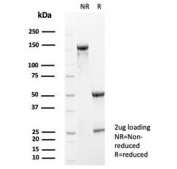 SDS-PAGE analysis of purified, BSA-free S100A5 antibody (clone S100A5/7474) as confirmation of integrity and purity.
