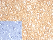 IHC staining of FFPE human brain tissue with S100A5 antibody (clone S100A5/7474). Inset: PBS used in place of primary Ab (secondary Ab negative control). HIER: boil tissue sections in pH 9 10mM Tris with 1mM EDTA for 20 min and allow to cool before testing.