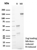 SDS-PAGE analysis of purified, BSA-free S100 calcium binding protein A5 antibody (clone S100A5/7475) as confirmation of integrity and purity.