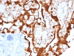 IHC staining of FFPE human placental tissue with S100A11 antibody (clone S100A11/7392). Inset: PBS used in place of primary Ab (secondary Ab negative control). HIER: boil tissue sections in pH 9 10mM Tris with 1mM EDTA for 20 min and allow to cool before testing.