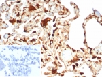 IHC staining of FFPE human lung tissue with S100A11 antibody (clone S100A11/7392). Inset: PBS used in place of primary Ab (secondary Ab negative control). HIER: boil tissue sections in pH 9 10mM Tris with 1mM EDTA for 20 min and allow to cool before testing.