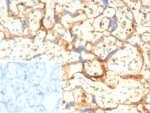 IHC staining of FFPE human placental tissue with S100A11 antibody (clone S100A11/7393). Inset: PBS used in place of primary Ab (secondary Ab negative control). HIER: boil tissue sections in pH 9 10mM Tris with 1mM EDTA for 20 min and allow to cool before testing.