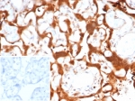 IHC staining of FFPE human placental tissue with S100 calcium binding protein A11 antibody (clone S100A11/7394). Inset: PBS used in place of primary Ab (secondary Ab negative control). HIER: boil tissue sections in pH 9 10mM Tris with 1mM EDTA for 20 min and allow to cool before testing.