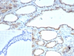 IHC staining of FFPE human thyroid tissue with S100A13 antibody (clone S100A13/7484). Inset: PBS used in place of primary Ab (secondary Ab negative control). HIER: boil tissue sections in pH 9 10mM Tris with 1mM EDTA for 20 min and allow to cool before testing.