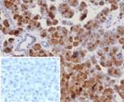 IHC staining of FFPE human pancreas tissue with ROR gamma antibody (clone RORC/8132R). Inset: PBS used in place of primary Ab (secondary Ab negative control). HIER: boil tissue sections in pH 9 10mM Tris with 1mM EDTA for 20 min and allow to cool before testing.