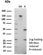 SDS-PAGE analysis of purified, BSA-free recombinant ROR gamma antibody (clone RORC/8278R) as confirmation of integrity and purity.