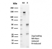 SDS-PAGE analysis of purified, BSA-free S100A12 antibody (clone S100A12/8952R) as confirmation of integrity and purity.