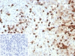 IHC staining of FFPE human spleen tissue with CGRP antibody (clone S100A12/8952R). Inset: PBS used in place of primary Ab (secondary Ab negative control). HIER: boil tissue sections in pH 9 10mM Tris with 1mM EDTA for 20 min and allow to cool before testing.