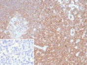 IHC staining of FFPE human lymph node tissue with recombinant CD48 antibody (clone rCD48/8676). Inset: PBS used in place of primary Ab (secondary Ab negative control). HIER: boil tissue sections in pH 9 10mM Tris with 1mM EDTA for 20 min and allow to cool before testing.