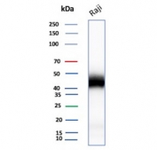 Western blot testing of human Raji cell lysate with recombinant  CD48 antibody. Predicted molecular weight: 28-50 kDa depending on glycosylation level.