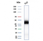 IHC staining of FFPE human lymph node tissue with recombinant CD48 antibody (clone rCD48/8676). Inset: PBS used in place of primary Ab (secondary Ab negative control). HIER: boil tissue sections in pH 9 10mM Tris with 1mM EDTA for 20 min and allow to cool before testing.