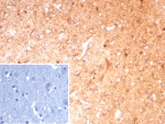IHC staining of FFPE human brain tissue with GLUL antibody (clone GLUL/8889R). Inset: PBS used in place of primary Ab (secondary Ab negative control). HIER: boil tissue sections in pH 9 10mM Tris with 1mM EDTA for 20 min and allow to cool before testing.