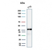 Western blot testing of human Y79 cell lysate with Glutamine Synthetase antibody. Predicted molecular weight ~42 kDa.