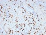 IHC staining of FFPE human brain tissue with GLUL antibody (clone GLUL/8996R). HIER: boil tissue sections in pH 9 10mM Tris with 1mM EDTA for 20 min and allow to cool before testing.