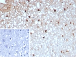 IHC staining of FFPE human brain tissue with GLUL antibody (clone GLUL/8996R). Inset: PBS used in place of primary Ab (secondary Ab negative control). HIER: boil tissue sections in pH 9 10mM Tris with 1mM EDTA for 20 min and allow to cool before testing.