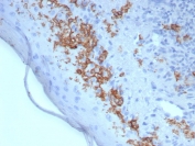 IHC staining of FFPE human skin tissue with CD1a antibody (clone rC1A/8110). HIER: boil tissue sections in pH 9 10mM Tris with 1mM EDTA for 20 min and allow to cool before testing.