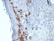IHC staining of FFPE human skin tissue with CD1a antibody (clone C1A/8111R). HIER: boil tissue sections in pH 9 10mM Tris with 1mM EDTA for 20 min and allow to cool before testing.