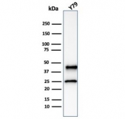 Western blot testing of human Y79 cell lysate with Glutamine Synthetase antibody (clone GLUL/6601). Predicted molecular weight ~42 kDa.