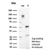 SDS-PAGE analysis of purified, BSA-free MHC class I related protein 1 antibody (clone MR1/7577) as confirmation of integrity and purity.