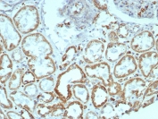 IHC staining of FFPE human kidney tissue with MR1 antibody (clone MR1/7577). HIER: boil tissue sections in pH 9 10mM Tris with 1mM EDTA for 20 min and allow to cool before testing.