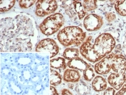 IHC staining of FFPE human kidney tissue with MR1 antibody (clone MR1/7579). Inset: PBS used in place of primary Ab (secondary Ab negative control). HIER: boil tissue sections in pH 9 10mM Tris with 1mM EDTA for 20 min and allow to cool before testing.