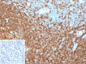 IHC staining of FFPE human tonsil tissue with CD45RA antibody (clone PTPRC/4367R). Inset: PBS used in place of primary Ab (secondary Ab negative control). HIER: boil tissue sections in pH 9 10mM Tris with 1mM EDTA for 20 min and allow to cool before testing.