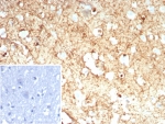 IHC staining of FFPE human brain tissue with GLUL antibody (clone rGLUL/8621). Inset: PBS used in place of primary Ab (secondary Ab negative control). HIER: boil tissue sections in pH 9 10mM Tris with 1mM EDTA for 20 min and allow to cool before testing.