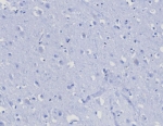 Negative control: IHC testing of FFPE human brain tissue with CD45RA antibody (clone PTPRC/8124R) at 2ug/ml. HIER: boil tissue sections in pH 9 10mM Tris with 1mM EDTA for 20 min and allow to cool before testing.