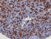 IHC staining of FFPE human tonsil tissue with CD45RA antibody (clone PTPRC/8124R). HIER: boil tissue sections in pH 9 10mM Tris with 1mM EDTA for 20 min and allow to cool before testing.