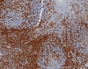 IHC staining of FFPE human tonsil tissue with CD45RA antibody (clone PTPRC/8124R). HIER: boil tissue sections in pH 9 10mM Tris with 1mM EDTA for 20 min and allow to cool before testing.