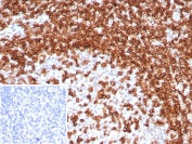 IHC staining of FFPE human tonsil tissue with CD45RA antibody (clone T200/8144R). Inset: PBS used in place of primary Ab (secondary Ab negative control). HIER: boil tissue sections in pH 9 10mM Tris with 1mM EDTA for 20 min and allow to cool before testing.