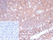 IHC staining of FFPE human tonsil tissue with CD45 antibody (clone PTPRC/6780). Inset: PBS used in place of primary Ab (secondary Ab negative control). HIER: boil tissue sections in pH 9 10mM Tris with 1mM EDTA for 20 min and allow to cool before testing.