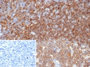 IHC staining of FFPE human tonsil tissue with CD45 antibody (clone PTPRC/6862). Inset: PBS used in place of primary Ab (secondary Ab negative control). HIER: boil tissue sections in pH 9 10mM Tris with 1mM EDTA for 20 min and allow to cool before testing.
