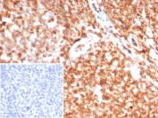 IHC staining of FFPE human tonsil tissue with CD45 antibody (clone rPTPRC/7275). Inset: PBS used in place of primary Ab (secondary Ab negative control). HIER: boil tissue sections in pH 9 10mM Tris with 1mM EDTA for 20 min and allow to cool before testing.