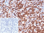 IHC staining of FFPE human spleen tissue with CD45 antibody (clone rPTPRC/1147). Inset: PBS used in place of primary Ab (secondary Ab negative control). HIER: boil tissue sections in pH 9 10mM Tris with 1mM EDTA for 20 min and allow to cool before testing.