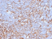 IHC staining of FFPE human tonsil tissue with CD21 antibody (clone CR2/6683). HIER: boil tissue sections in pH 9 10mM Tris with 1mM EDTA for 20 min and allow to cool before testing.
