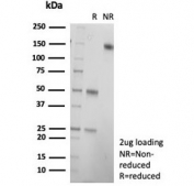 SDS-PAGE analysis of purified, BSA-free recombinant CD21 antibody (clone rCR2/6964) as confirmation of integrity and purity.