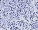 Negative control: IHC testing of FFPE human brain tissue with CD45RA antibody (clone PTPRC/8341R) at 2ug/ml. HIER: boil tissue sections in pH 9 10mM Tris with 1mM EDTA for 20 min and allow to cool before testing.