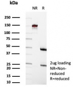 SDS-PAGE analysis of purified, BSA-free CD35 antibody (clone rCR1/8600) as confirmation of integrity and purity.