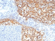 IHC staining of FFPE human tonsil tissue with CD21 antibody (clone CR2/7185R). Inset: PBS used in place of primary Ab (secondary Ab negative control). HIER: boil tissue sections in pH 9 10mM Tris with 1mM EDTA for 20 min and allow to cool before testing.