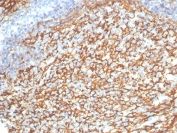 IHC staining of FFPE human tonsil tissue with CD21 antibody (clone CR2/7185R). HIER: boil tissue sections in pH 9 10mM Tris with 1mM EDTA for 20 min and allow to cool before testing.