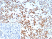 IHC staining of FFPE human tonsil tissue with CD21 antibody (clone CR2/8769R). Inset: PBS used in place of primary Ab (secondary Ab negative control). HIER: boil tissue sections in pH 9 10mM Tris with 1mM EDTA for 20 min and allow to cool before testing.