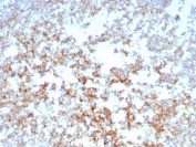 IHC staining of FFPE human tonsil tissue with CD21 antibody (clone CR2/8769R). HIER: boil tissue sections in pH 9 10mM Tris with 1mM EDTA for 20 min and allow to cool before testing.