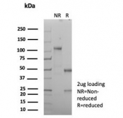 SDS-PAGE analysis of purified, BSA-free CD21 antibody (clone CR2/8880R) as confirmation of integrity and purity.