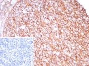 IHC staining of FFPE human tonsil tissue with CD21 antibody (clone CR2/8880R). Inset: PBS used in place of primary Ab (secondary Ab negative control). HIER: boil tissue sections in pH 9 10mM Tris with 1mM EDTA for 20 min and allow to cool before testing.
